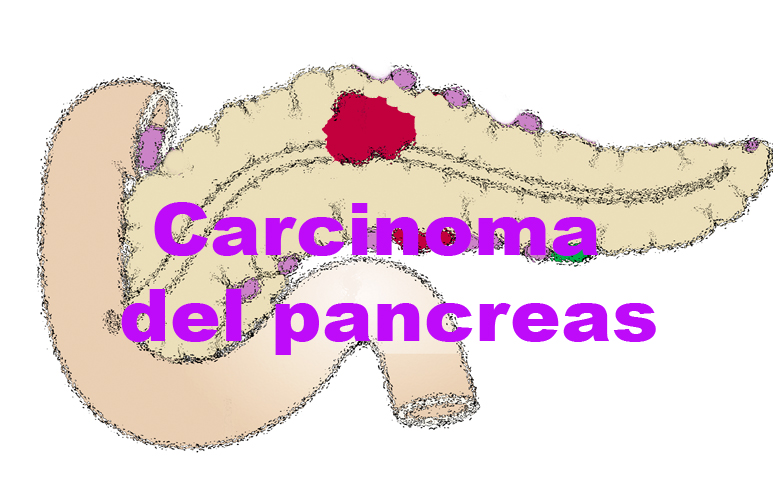 124_Pancreas
