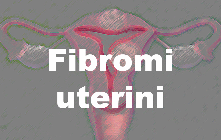 182_Fibroma uterino