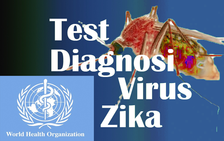 217_Diagnosi Zika