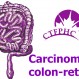 225_Carcinoma colon-rettale