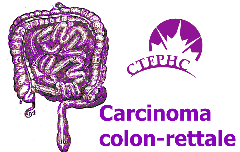 225_Carcinoma colon-rettale