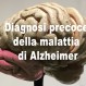 307_Alzheimer