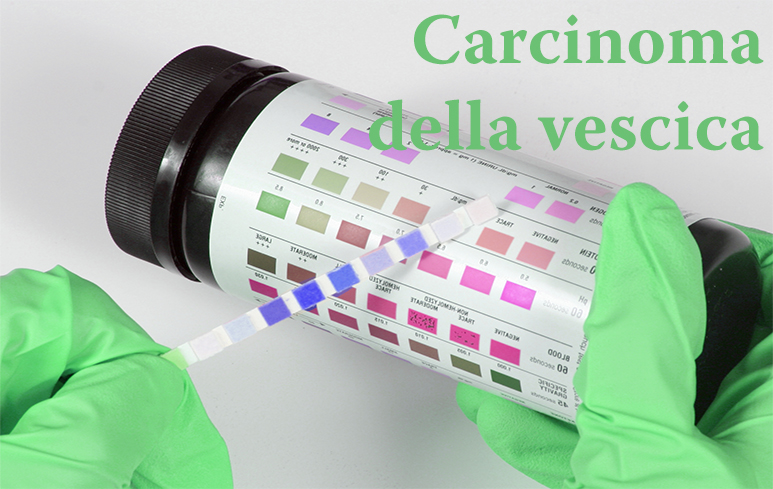403_carcinoma-vescica