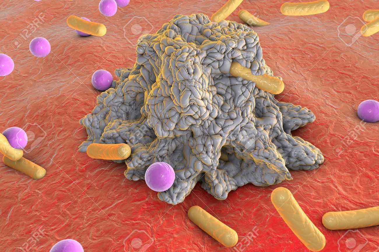 fagocitosi-macrofagi-inghiotte-batteri