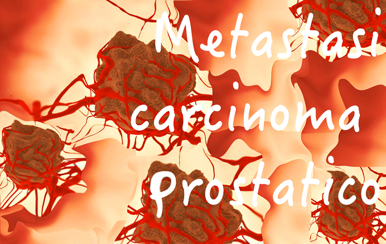 454_Carcinoma Prostatico
