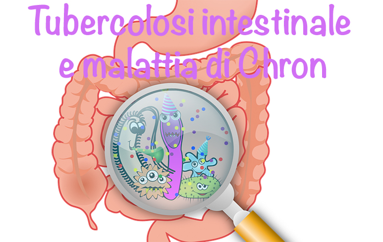 459_Tbc intestinale Chron
