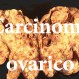 473_carcinoma ovarico