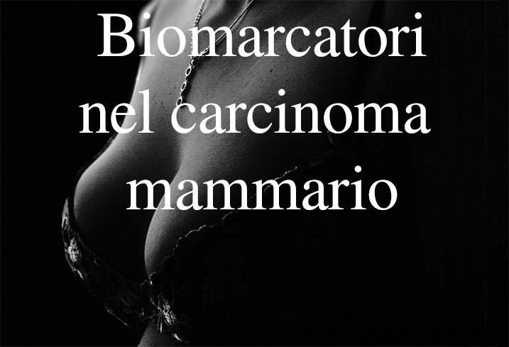 492_Carcinoma mammario