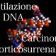 523_Carcinoma cortico surrenalico