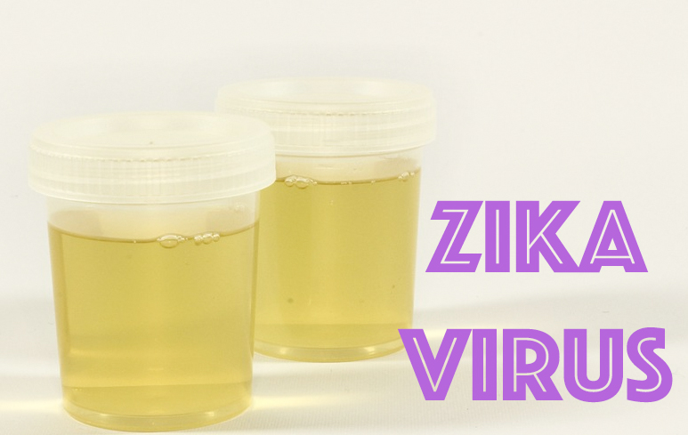 532_K Virus Zika