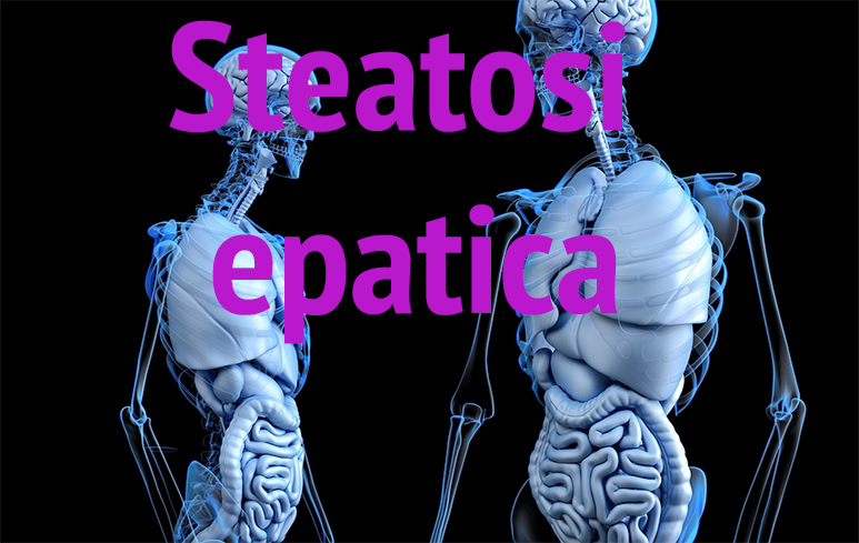 609_Steatosi epatica