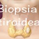 832_Biopsia tiroide