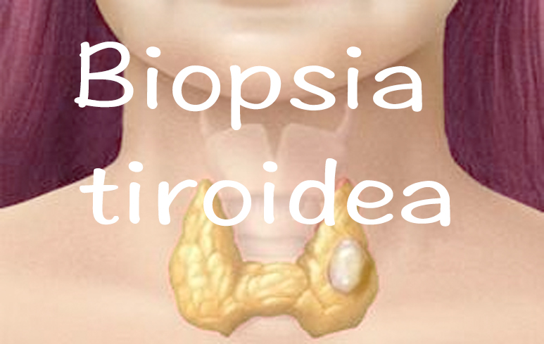 832_Biopsia tiroide