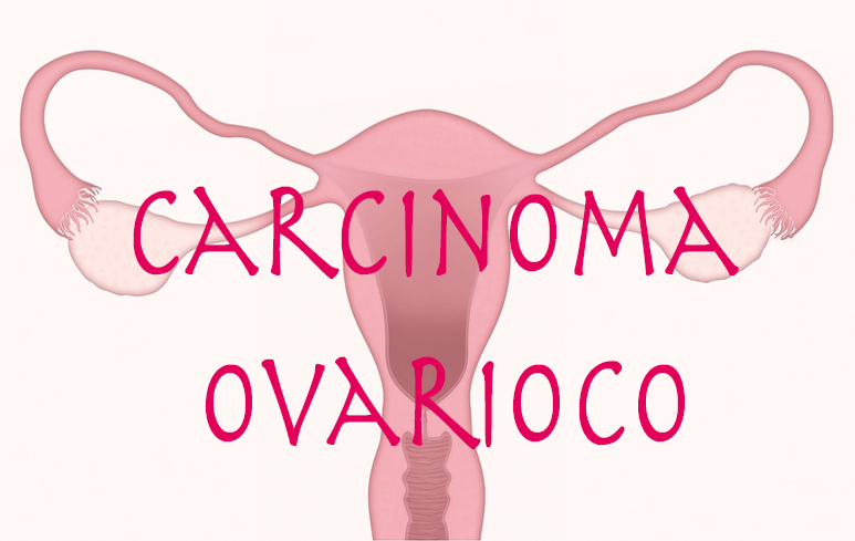 902_Carcinoma ovarico
